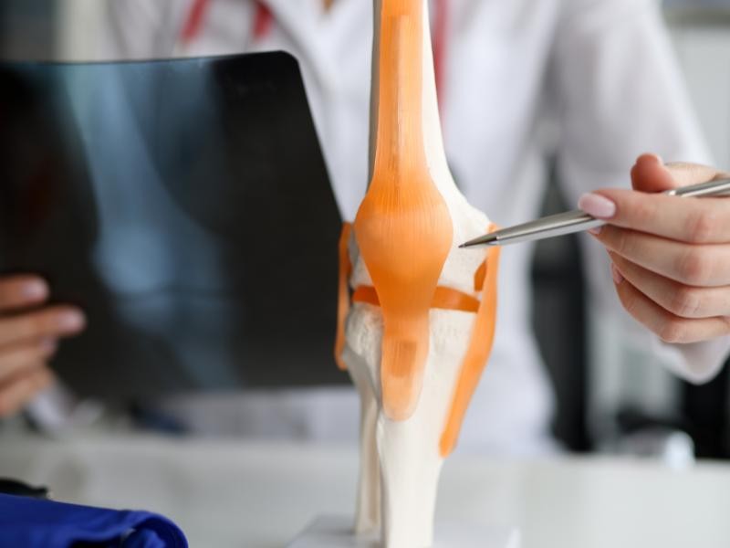 Como a Reumatologia pode ajudar no tratamento de doenças autoimunes